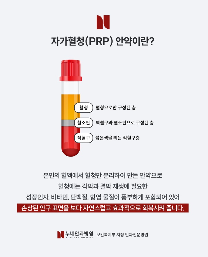 자가혈청안약에 대한 기본적인 설명