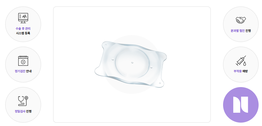 렌즈삽입술 이후 주의사항을 설명하며 누네안과에서 소개하는 성공적인 렌즈삽입술을 위해 수술 후 관리 및 정기/정밀검사 등 진행해야 한다는 시각자료 