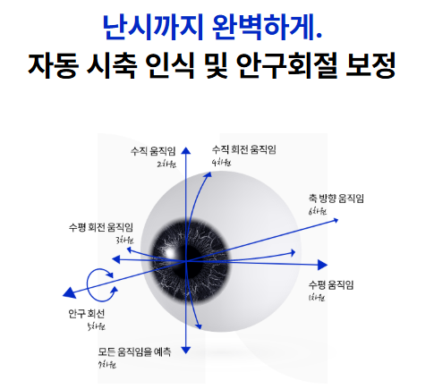 누네안과병원에서 사용하는 스마트라식의 세부장
