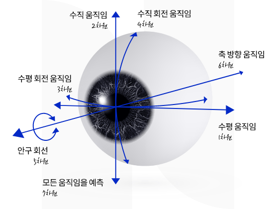 스마트라식의 장점인 난시까지 완벽하게 자동시축 인식 및 안구회절까지 보정한다는 자