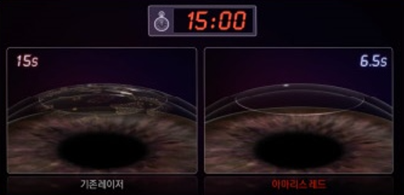 서울투데이라섹가격, 일반 라섹과 차이 있을까?