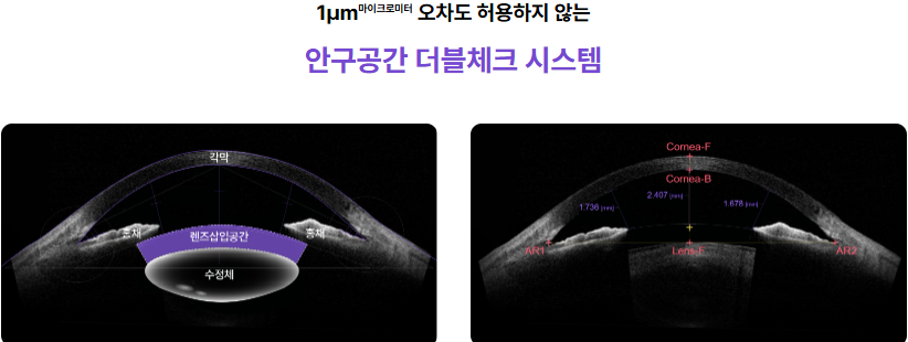 누네안과병원에서 시행하고 있는 렌즈삽입술 수술의 장점에 대해 설명하는 시각적인 보조자료